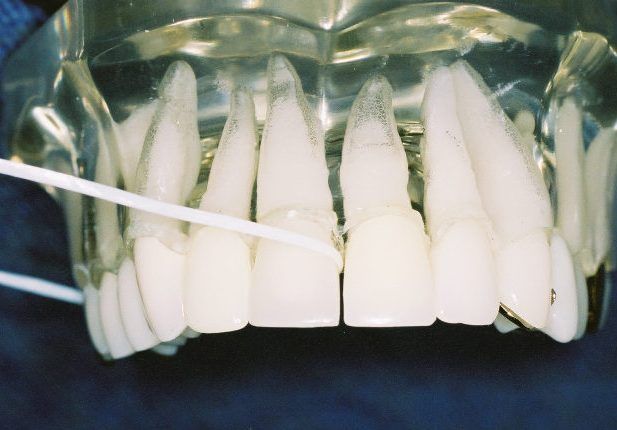 Flossing your teeth 2