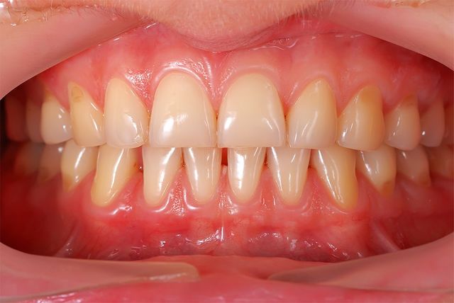periodontics / gum treatment